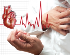 Phòng ngừa đột quỵ ở người trẻ